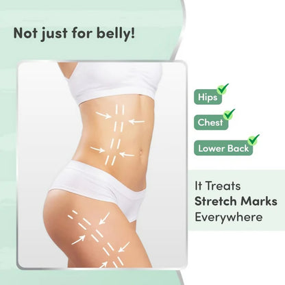 Mylo Care Stretch Marks Oil - with Sea Buckthorn - 100 ml