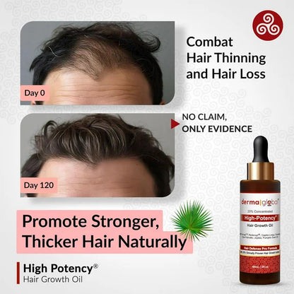 Derma Global High Potency Hair Growth Oil - 60 ml