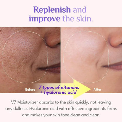 It's Skin V7 Hyaluronic Moisturizer - 50 ml