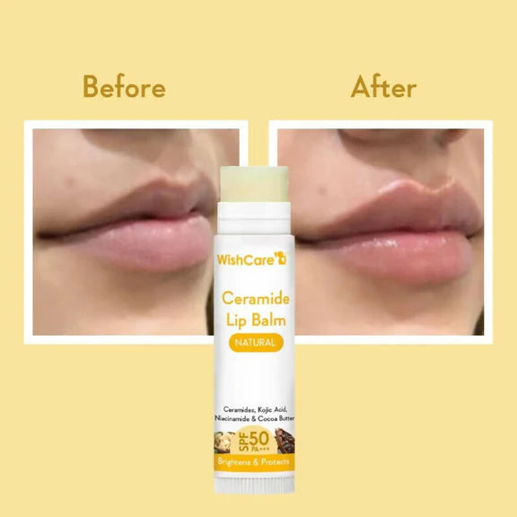 Wishcare Ceramide Lip Balm with SPF50 PA+++ - Natural - 5 gm