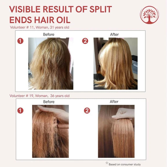Ivory Natural Splits Ends Repair Hair Oil - Natural Hair Therapy For Split Ends And Hair Wellness - 200 ml