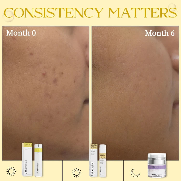 DIVE-IN C - 20% Vitamin C Serum For Face (30ml)