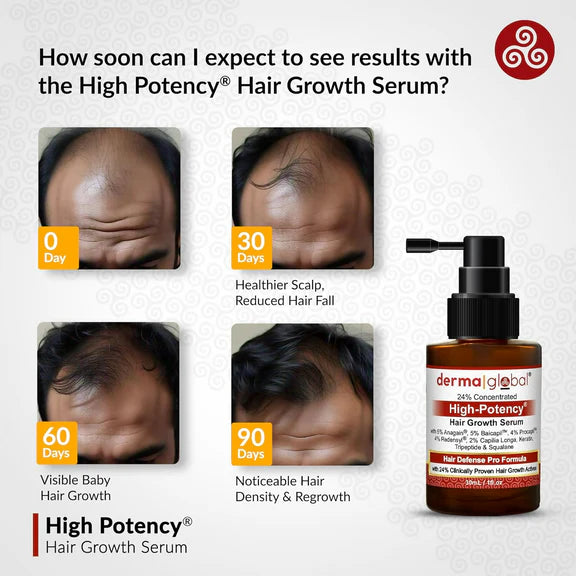 Derma Global High Potency Hair Growth Serum - 30 ml - Pack of 1