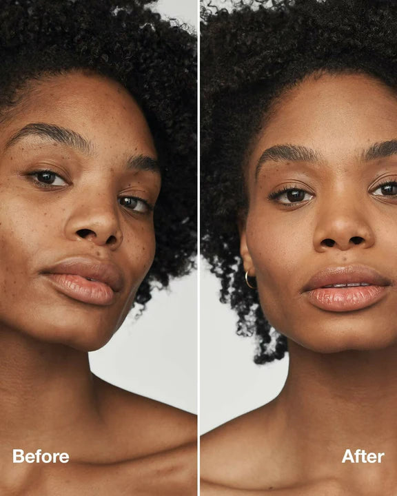 Clinique Even Better Clinical Serum Foundation SPF 20 - WN 112 Ginger (M) - 30 ml