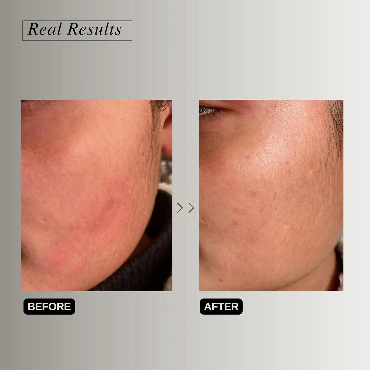 The Formularx Peptide Ceramide Moisturizer - Barrier Plus - 50 gm