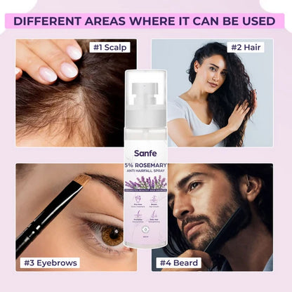Sanfe 5% Rosemary Anti Hairfall Spray - 100 ml
