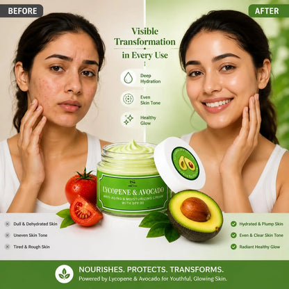 Milky Moon Lycopene & Avocado Anti-Aging & Moisturizing Cream with SPF 30 - 50 gm