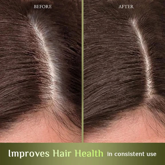 Richfeel Hair Nourisher Oil - Hair Fall Control & Growth Treatment - 10 ml