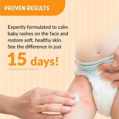 Fixderma Baby Hoopoe Diaper Rash Cream with Zinc Oxide & Panthenol - 50 gm