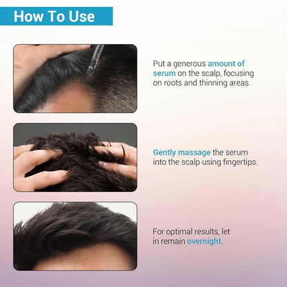 Sotrue Hair Growth Serum With Redensyl 3%, Procapil 3%, Anagain 4% and Baicapil 2% Hair Growth Actives - 30 ml