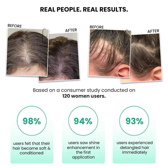 ThriveCo Rosemary Water Hair Spray For Hair Growth - 100 ml