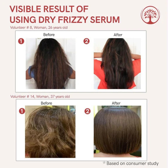 Ivory Natural Dry Frizzy Hair Serum Moisturizes Dry Strands, Detangles Hair - 50 ml