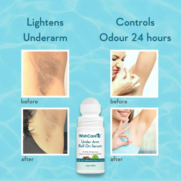 Wishcare Underarm Roll On Serum - 50 ml